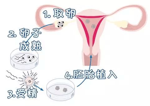 个人代孕