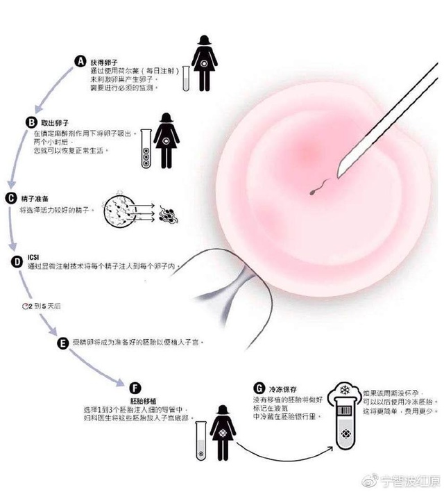个人代孕