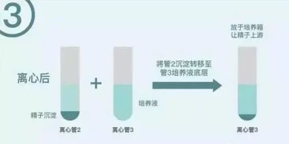 不育不孕