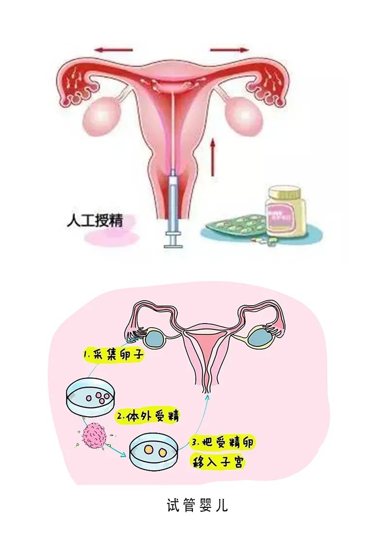 中国代孕市场