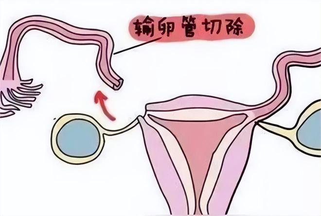 不孕