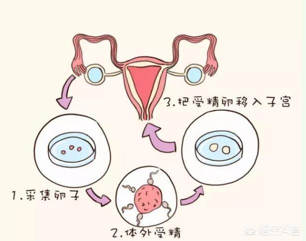 不孕不育症